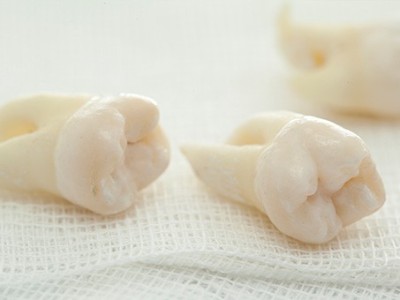 智齒疼了，這牙非拔不可嗎？